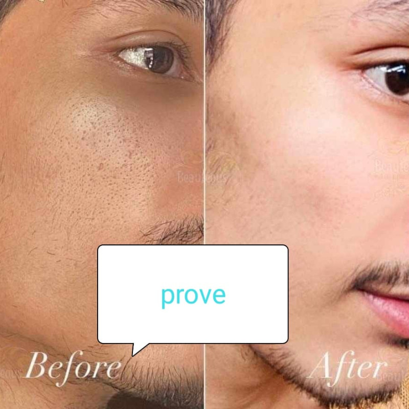 milk soothing-gel